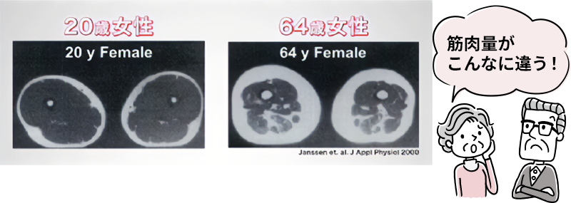 年代別の大腿筋肉断面図
